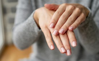 Manchas blancas en las uñas