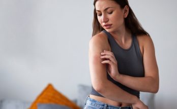 Remedios caseros para la dermatitis atópica